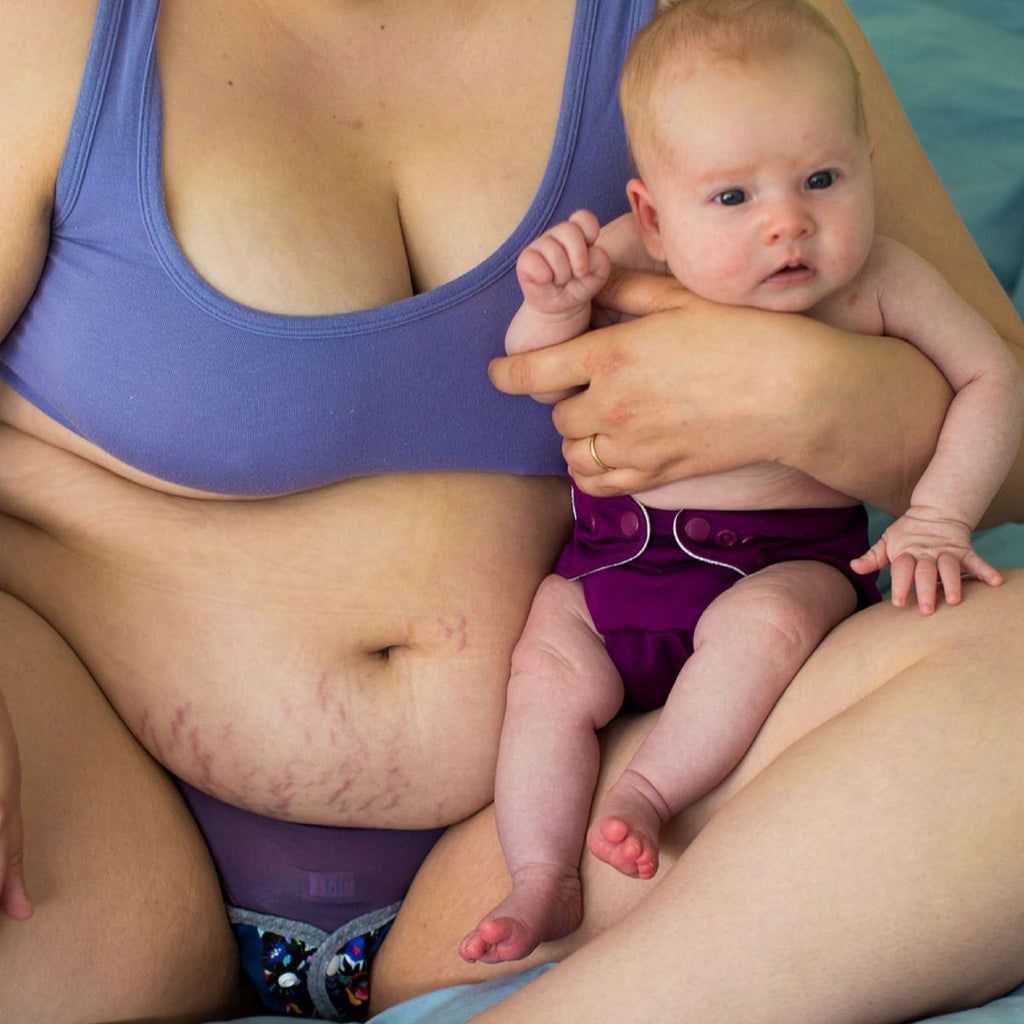 Let’s Talk About Postpartum Body Image
